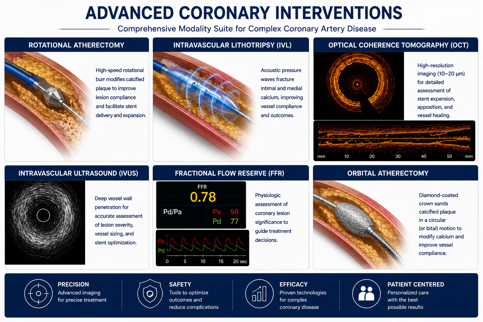 advance-coronary-intervention